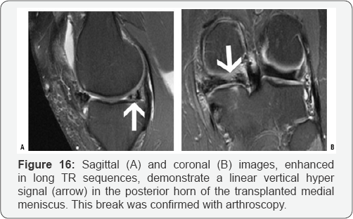 Click here to view Large Figure 16