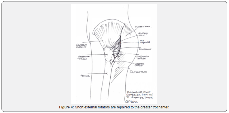 Click here to view Large Figure 4