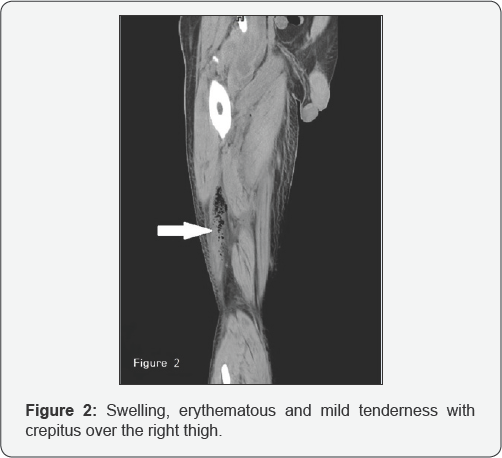 Click here to view Large Figure 2