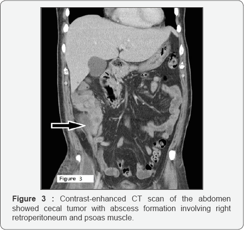 Click here to view Large Figure 3