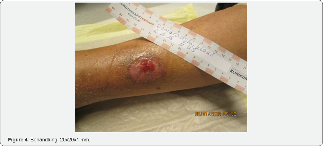 Click here to view Large Figure 4