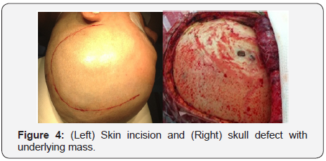 Click here to view Large Figure 4