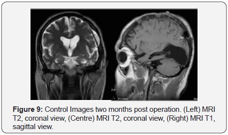 Click here to view Large Figure 9