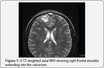 Click here to view Large Figure 1