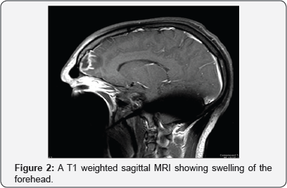 Click here to view Large Figure 2