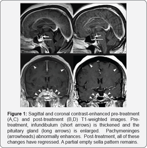 Click here to view Large Figure 1