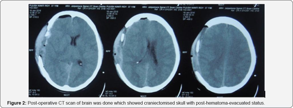 Click here to view Large Figure 2
