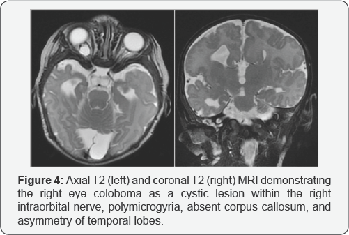 Click here to view Large Figure 4