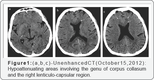 Click here to view Large Figure 1
