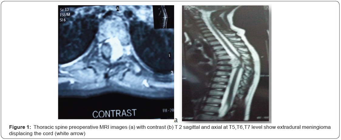 Click here to view Large Figure 1
