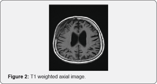 Click here to view Large Figure 1