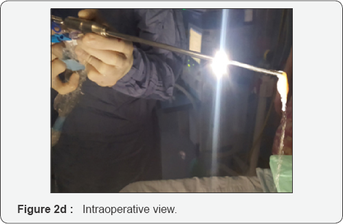 Click here to view Large Figure 2d