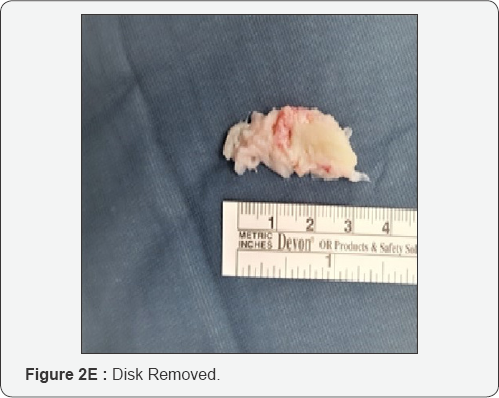 Click here to view Large Figure 2e