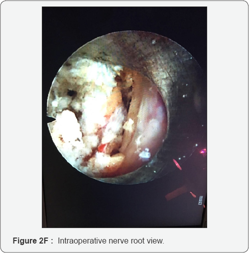 Click here to view Large Figure 2f