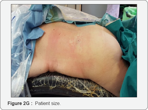 Click here to view Large Figure 2g