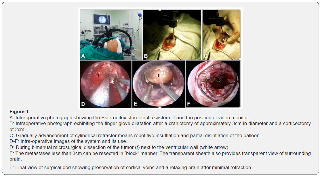 Click here to view Large Figure 1