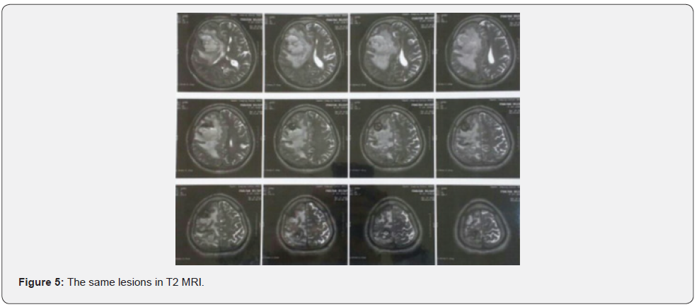 Click here to view Large Figure 5