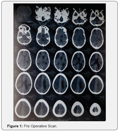 Click here to view Large Figure 1