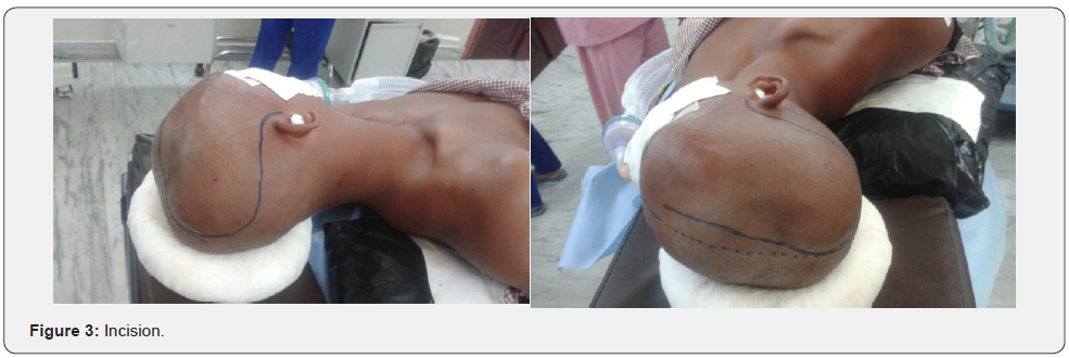 Click here to view Large Figure 3