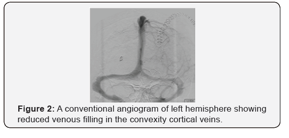 Click here to view Large Figure 2