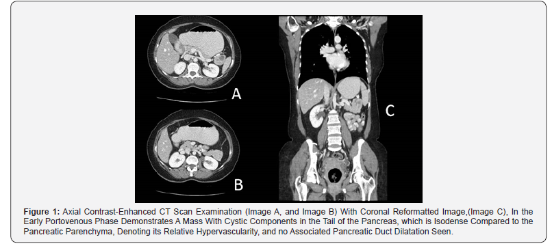Click here to view Large Figure 1 Open Access Journal of Neurology & Neurosurgery