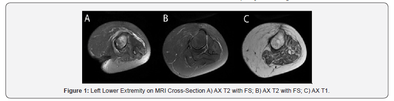 Click here to view Large Figure 1 JOpen Access Journal of Neurology & Neurosurgery