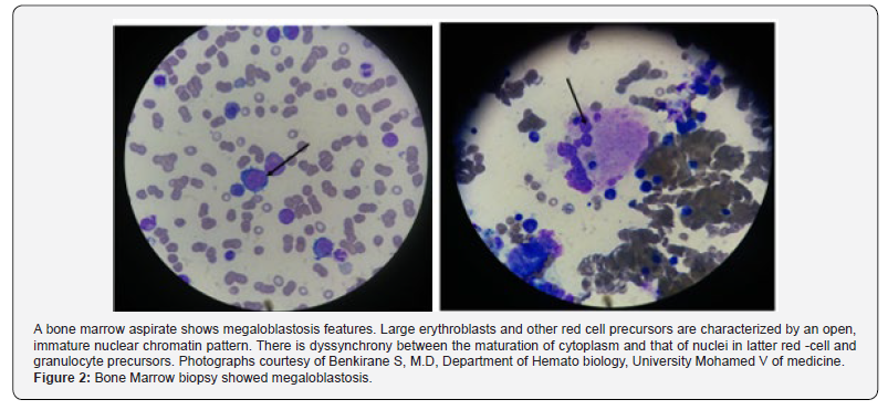 Click here to view Large Figure 2 Open Access Journal of Neurology & Neurosurgery