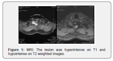 Click here to view Large Figure 1 Open Access Journal of Neurology & Neurosurgery