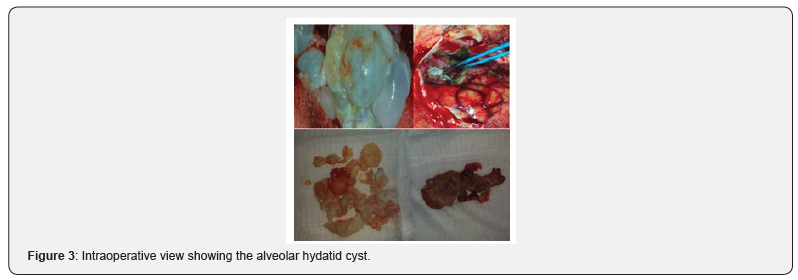 Click here to view Large Figure 3 Open Access Journal of Neurology & Neurosurgery
