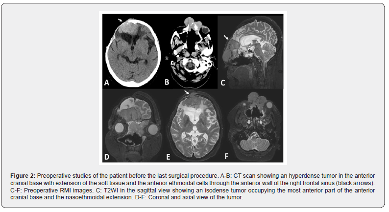 Click here to view Large Figure 2