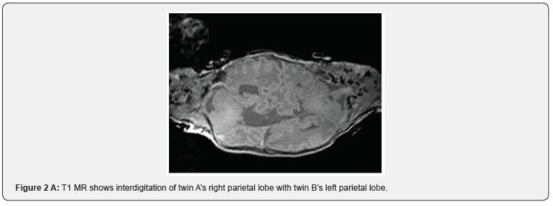 Click here to view Large Figure 2
