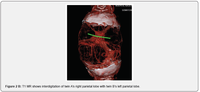 Click here to view Large Figure 3