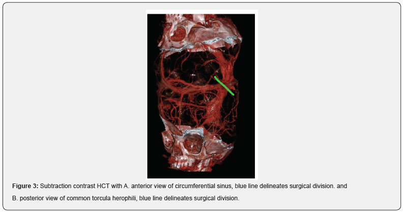 Click here to view Large Figure 4