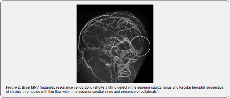 Click here to view Large Figure 2
