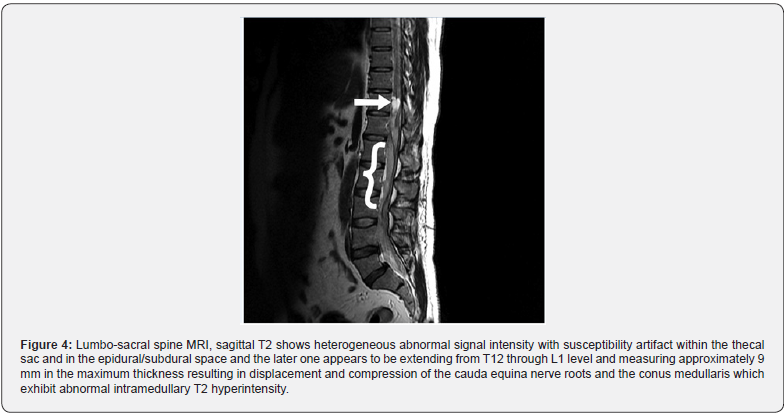 Click here to view Large Figure 4