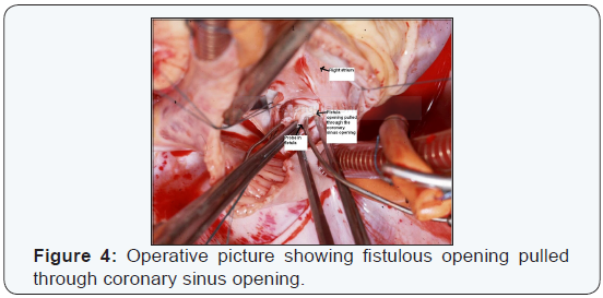 Click here to view Large Figure 4