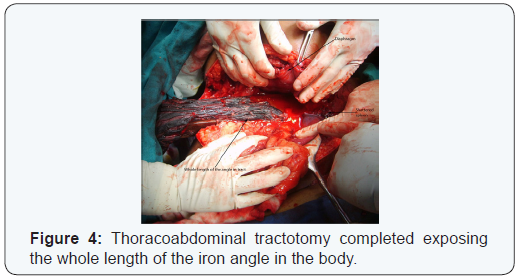 Click here to view Large Figure 4