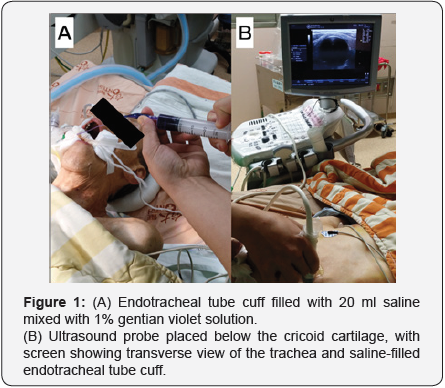 Click here to view Large Figure 1