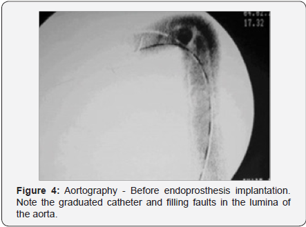 Click here to view Large Figure 4