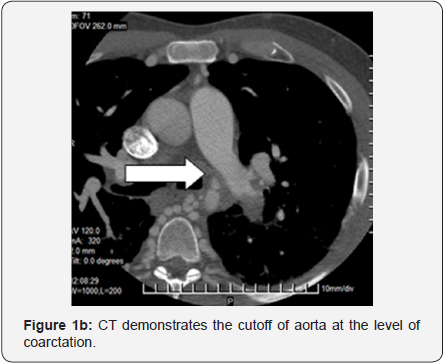 Click here to view Large Figure 2