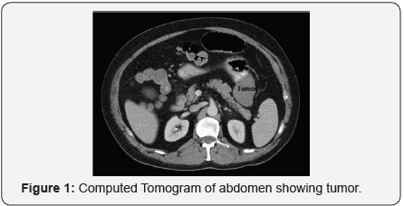 Click here to view Large Figure 1