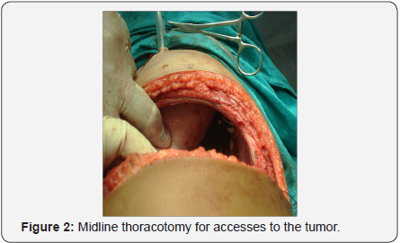 Click here to view Large Figure 2