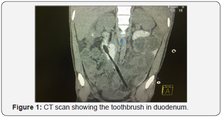 Click here to view Large Figure 1