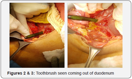 Click here to view Large Figure 2&3