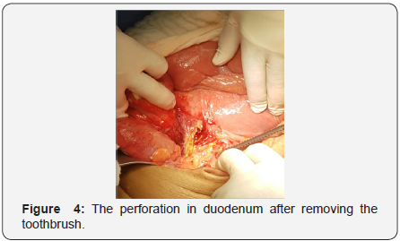 Click here to view Large Figure 4