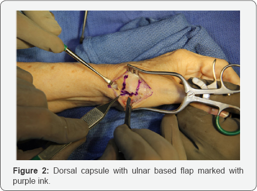 Click here to view Large Figure 2