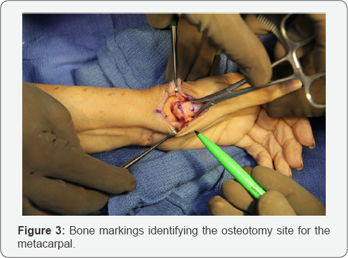 Click here to view Large Figure 3
