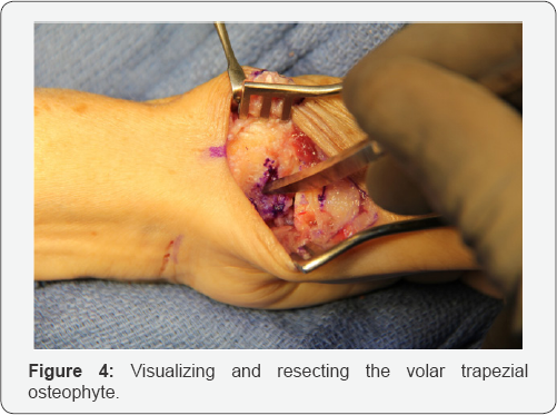 Click here to view Large Figure 4