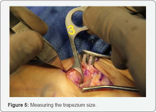 Click here to view Large Figure 1