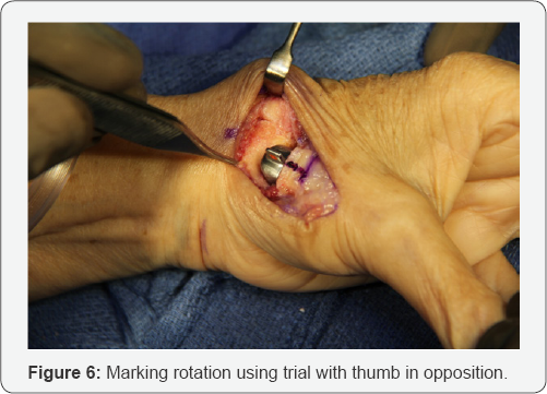 Click here to view Large Figure 6